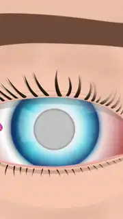 Eye Surgery capture 5