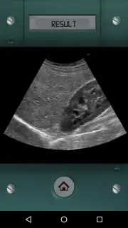 Scanner X-ray capture 3