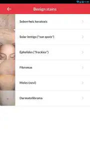 FotoSkin capture 13