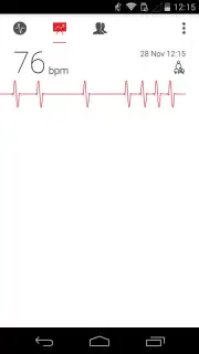 Cardiograph capture 4
