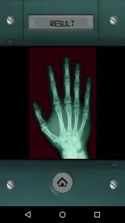 Scanner X-ray capture 5