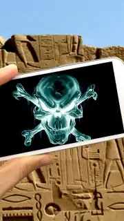 Рентгеновская сканера стена capture 7