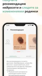 Про родинки capture 5