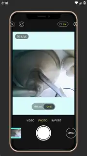 Fomz capture 4