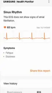 Samsung Health Monitor capture 1