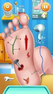 Foot Surgery Doctor Care capture 10