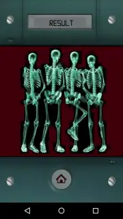 Scanner X-ray capture 1
