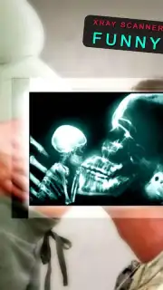 веселые рентгеновские лучи capture 3