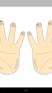 Diabetes:M capture 5