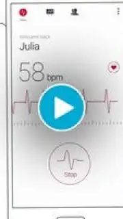 Cardiograph capture 1