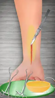 WristSurgeryDoctor capture 16