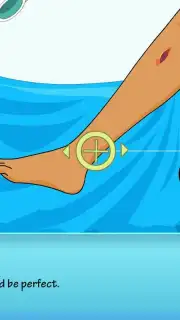 Operate Now Leg Surgery capture 4