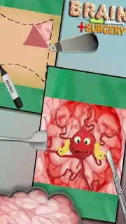 BrainSurgery capture 2
