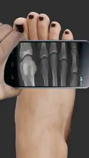 X Ray Scanner Pro capture 1