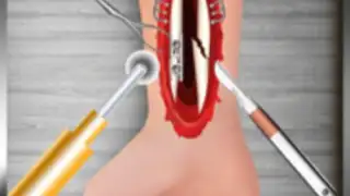 WristSurgeryDoctor
