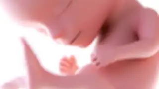 Mi Embarazo
