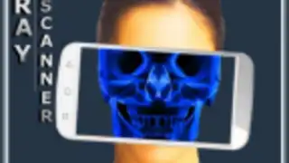 Scanner X-ray