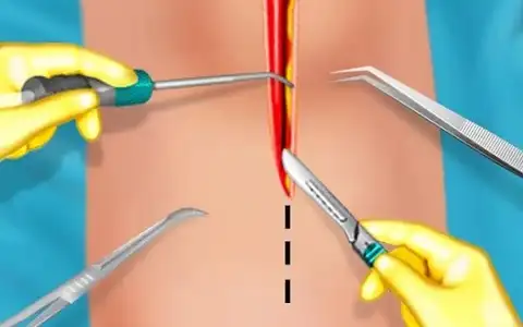 KneeSurgery capture 2